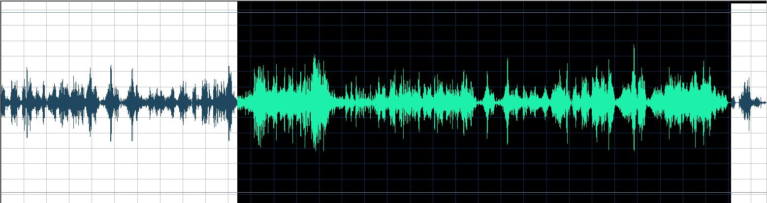 Fischer waveform