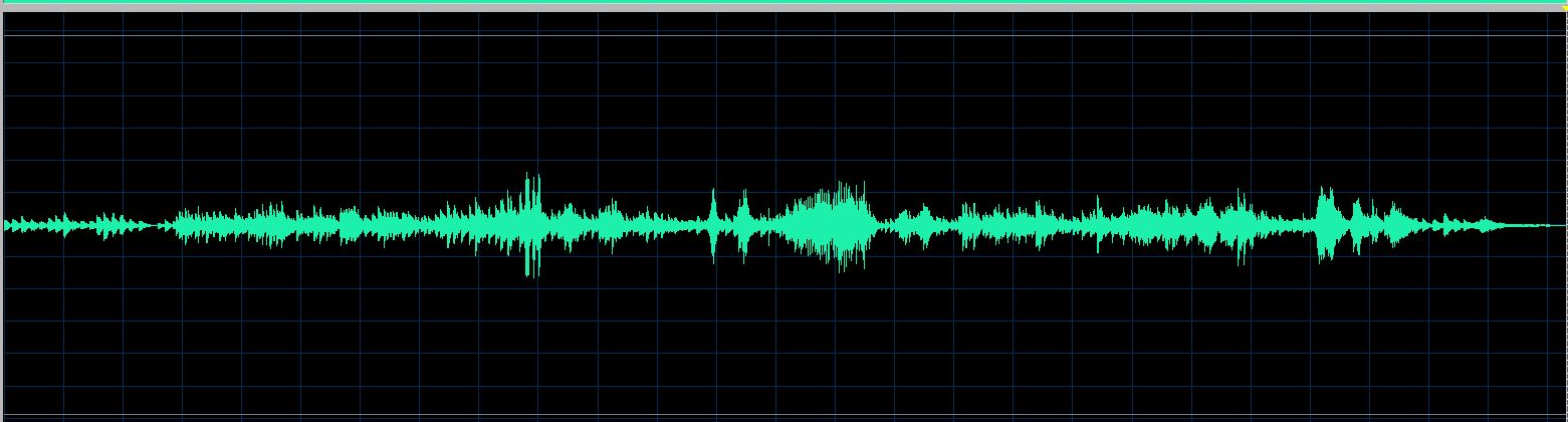 Trzeciak waveform