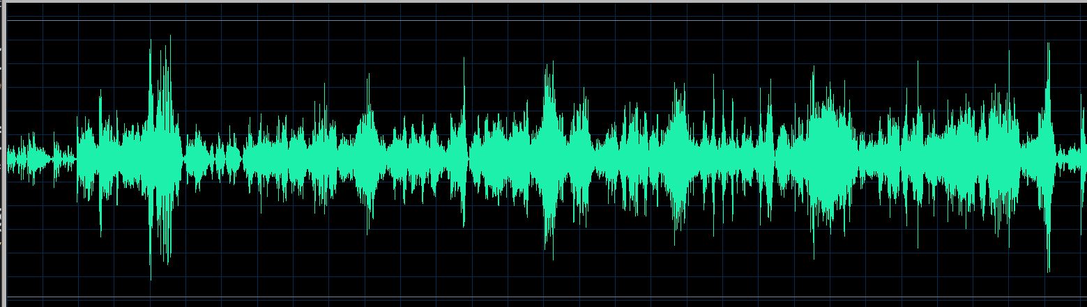 Trzeciak waveform