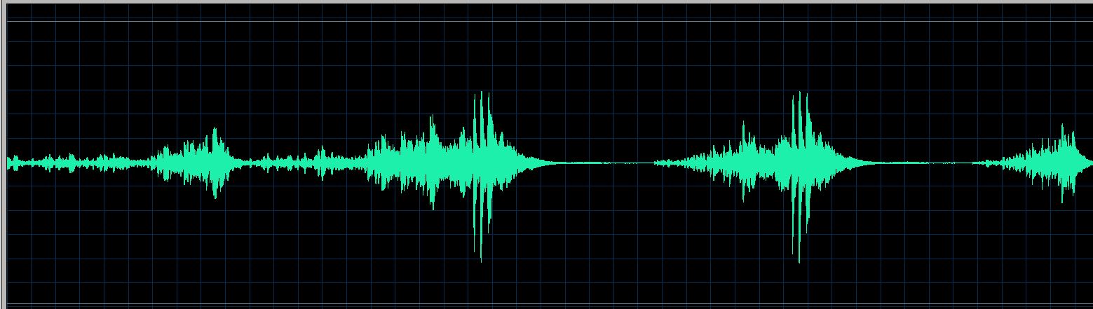 Lortie waveform