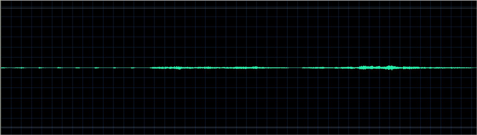 Bernd Glemser waveform